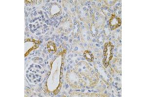 Immunohistochemistry of paraffin-embedded rat kidney using KRT20 Antibody. (KRT20 antibody  (AA 245-424))