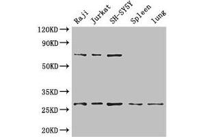 Western Blot Positive WB detected in: Raji whole cell lysate, Jurkat whole cell lysate, SH-SY5Y whole cell lysate, Mouse spleen tissue, Mouse lung tissue All lanes: YWHAZ antibody at 3. (14-3-3 zeta antibody  (AA 133-212))