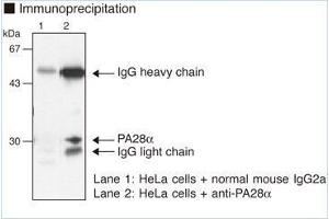 Western Blotting (WB) image for anti-Proteasome (Prosome, Macropain) Activator Subunit 1 (PA28 Alpha) (PSME1) antibody (ABIN1449243)