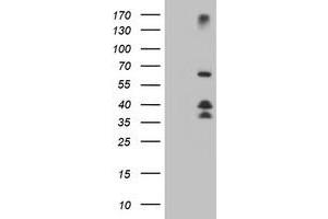HEK293T cells were transfected with the pCMV6-ENTRY control (Left lane) or pCMV6-ENTRY DTNB (Right lane) cDNA for 48 hrs and lysed. (Dystrobrevin beta antibody)