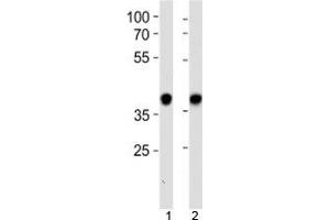 NPM1 antibody western blot analysis in 1) HeLa and 2) Jurkat lysate (NPM1 antibody  (AA 198-226))