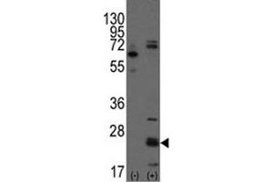 Western blot analysis of CD9 antibody and 293 cell lysate (2 ug/lane) either nontransfected (Lane 1) or transiently transfected with the CD9 gene (2). (CD9 antibody  (AA 21-51))