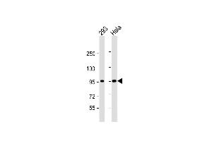 All lanes : Anti-CTNNB1 Antibody (C-term) at 1:1000 dilution Lane 1: 293 whole cell lysate Lane 2: Hela whole cell lysate Lysates/proteins at 20 μg per lane. (CTNNB1 antibody  (C-Term))