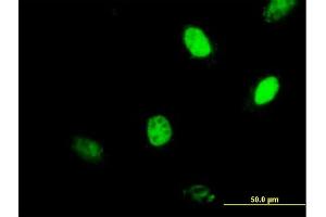 Immunofluorescence of purified MaxPab antibody to MGMT on HeLa cell. (MGMT antibody  (AA 1-207))