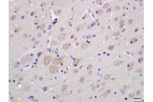 Formalin-fixed and paraffin embedded rat brain labeled with Anti-MOBP Polyclonal Antibody, Unconjugated  at 1:200 followed by conjugation to the secondary antibody and DAB staining. (MOBP antibody  (AA 7-90))