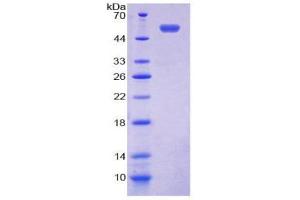 SDS-PAGE (SDS) image for Nucleoporin 153kDa (NUP153) (AA 1238-1468) protein (His tag,GST tag) (ABIN2123415)