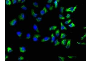 Immunofluorescence staining of Hela cells with ABIN7143811 at 1:133, counter-stained with DAPI. (ACTN1 antibody  (AA 1-204))