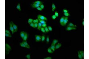 Immunofluorescence staining of HepG2 cells with ABIN7163417 at 1:66, counter-stained with DAPI. (PSAT1 antibody  (AA 104-206))
