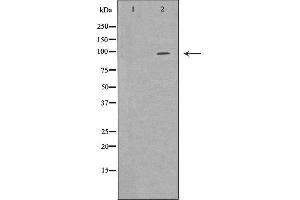 Western blot analysis of 293T whole cell lysates, using EPB41 Antibody. (EPB41 antibody  (Internal Region))