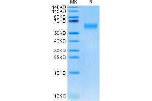 Cynomolgus IL-18RAP on Tris-Bis PAGE under reduced condition. (IL18RAP Protein (AA 20-356) (His tag))