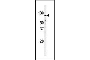 Western blot analysis of PFKM polyclonal antibody (ABIN392749 and ABIN2842203) in Hela cell line lysate. (PFKM antibody  (C-Term))