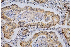 IHC analysis of BRG1 using anti-BRG1 antibody (ABIN7602029).