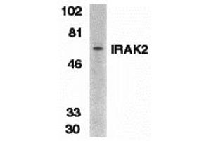 Western Blotting (WB) image for anti-Interleukin-1 Receptor-Associated Kinase 2 (IRAK2) (C-Term) antibody (ABIN1030444) (IRAK2 antibody  (C-Term))