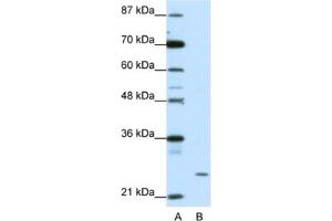 Western Blotting (WB) image for anti-Zinc Finger Protein 253 (ZNF253) antibody (ABIN2461909) (ZNF253 antibody)