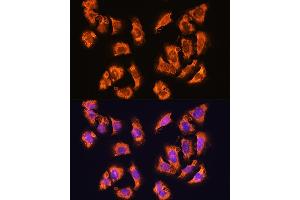 Immunofluorescence analysis of U2OS cells using alpha Sarcoglycan (alpha Sarcoglycan (SGCA)) Rabbit pAb (ABIN1682687, ABIN5664644, ABIN5664646 and ABIN6220497) at dilution of 1:100. (SGCA antibody  (AA 60-290))
