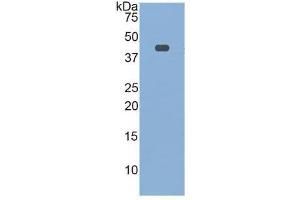 WB of Protein Standard: different control antibodies  against Highly purified E. (Transferrin Receptor 2 ELISA Kit)