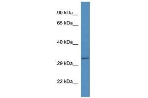 Western Blot showing Bend6 antibody used at a concentration of 1. (BEND6 antibody  (C-Term))