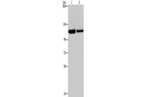 Gel: 6 % SDS-PAGE, Lysate: 40 μg, Lane 1-2: Hela cells, A172 cells, Primary antibody: ABIN7191819(PDE4A Antibody) at dilution 1/300, Secondary antibody: Goat anti rabbit IgG at 1/8000 dilution, Exposure time: 20 seconds (PDE4A antibody)