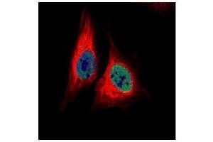 ICC/IF Image Confocal immunofluorescence analysis (Olympus FV10i) of paraformaldehyde-fixed HeLa, using TEAD4, antibody (Green) at 1:500 dilution. (TEAD4 antibody  (Center))