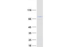 Western Blotting (WB) image for Midline 1 (MID1) (Transcript Variant 3) protein (Myc-DYKDDDDK Tag) (ABIN2726005)