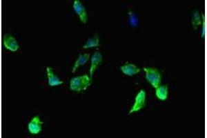 Immunofluorescent analysis of Hela cells using ABIN7145808 at dilution of 1:100 and Alexa Fluor 488-congugated AffiniPure Goat Anti-Rabbit IgG(H+L) (BRD3 antibody  (AA 356-506))