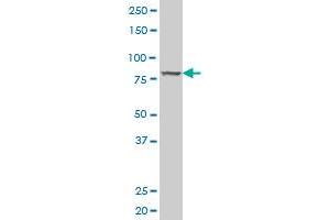 CDH11 polyclonal antibody (A01), Lot # 051121JC01 Western Blot analysis of CDH11 expression in HL-60 . (OB Cadherin antibody  (AA 509-617))