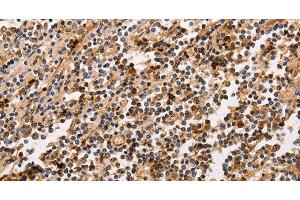 Immunohistochemistry of paraffin-embedded Human tonsil using PPP1CB Polyclonal Antibody at dilution of 1:30 (PPP1CB antibody)