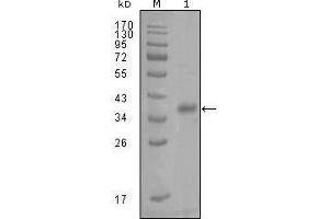 Western blot analysis using FABP4 mouse mAb against truncated Trx-FABP4 recombinant protein (1). (FABP4 antibody  (AA 61-121))