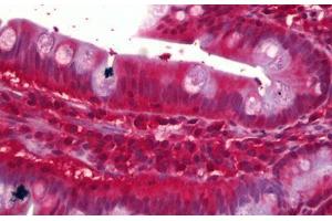 Anti-CNR2 / CB2 antibody IHC staining of human small intestine. (CNR2 antibody)