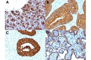 Immunohistochemical staining (Formalin-fixed paraffin-embedded sections) of human pancreas (A), human colon carcinoma (B), human cervical carcinoma (C) and human placenta (D) with MAML3 monoclonal antibody, clone MAML3/1303 . (MAML3 antibody)