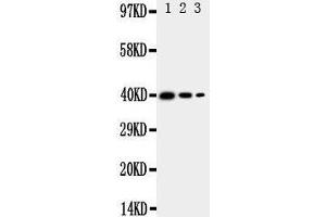 Western Blotting (WB) image for anti-Translocation Associated Membrane Protein 2 (TRAM2) (AA 309-325), (C-Term) antibody (ABIN3044050)