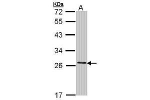 COMT antibody