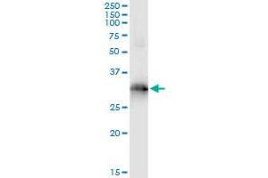 Immunoprecipitation of HOXB9 transfected lysate using anti-HOXB9 monoclonal antibody and Protein A Magnetic Bead , and immunoblotted with HOXB9 MaxPab rabbit polyclonal antibody. (HOXB9 antibody  (AA 65-163))