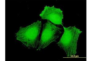 Immunofluorescence of purified MaxPab antibody to CEP57 on HeLa cell. (CEP57 antibody  (AA 1-500))