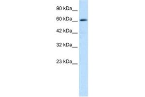 Western Blotting (WB) image for anti-Zinc Finger and BTB Domain Containing 45 (ZBTB45) antibody (ABIN2460149) (ZBTB45 antibody)