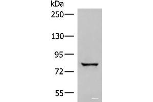 Western blot analysis of Human bladder transitional cell carcinoma grade 2-3 tissue lysate using TTC12 Polyclonal Antibody at dilution of 1:300 (TTC12 antibody)