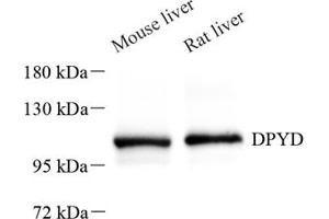 Western blot analysis of DPD (ABIN7073735),at dilution of 1: 600 (DPYD antibody)