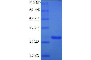 Thymidylate Kinase (Tmk) (AA 1-208) protein (His tag) expressed in E. (Thymidylate Kinase Protein (Tmk) (AA 1-208) (His tag))