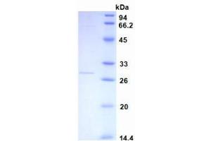 SDS-PAGE analysis of recombinant Human CRP.