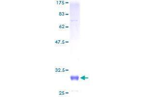 ZDHHC8 Protein (AA 1-42) (GST tag)