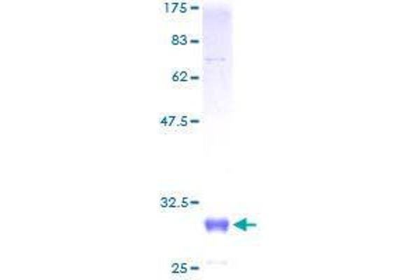 ZDHHC8 Protein (AA 1-42) (GST tag)