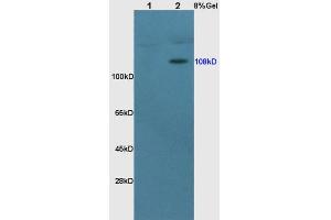 Lane 1: rat brain lysates Lane 2: rat kidney lysates probed with Anti MCR Polyclonal Antibody, Unconjugated  at 1:200 in 4˚C. (NR3C2 antibody  (AA 601-700))