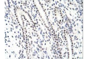 Image no. 1 for anti-Zinc Finger Protein 296 (ZNF296) (C-Term) antibody (ABIN6736191) (Zinc Finger Protein 296 (ZNF296) (C-Term) antibody)