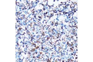 Immunohistochemistry of paraffin-embedded human tonsil using SPN antibody (ABIN2560118) at dilution of 1:100 (40x lens).