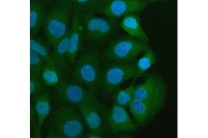 IF analysis of MIF using anti-MIF antibody (ABIN3043878).