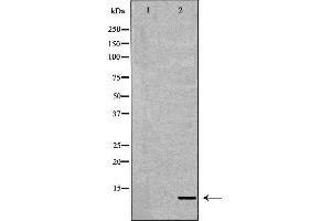 Western blot analysis of extracts of K-562, using S100A8 antibody. (S100A8 antibody  (C-Term))