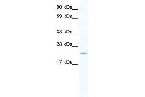 Human Placenta; WB Suggested Anti-SERTAD1 Antibody. (SERTAD1 antibody  (N-Term))
