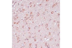 Immunohistochemistry of paraffin-embedded rat brain using RPL32 antibody (ABIN6129104, ABIN6147138, ABIN6147139 and ABIN6216824) at dilution of 1:100 (40x lens). (RPL32 antibody  (AA 1-135))