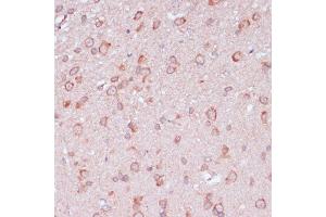 Immunohistochemistry of paraffin-embedded rat brain using RPL32 antibody (ABIN6129104, ABIN6147138, ABIN6147139 and ABIN6216824) at dilution of 1:100 (40x lens).