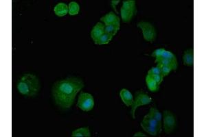 Immunofluorescent analysis of MCF-7 cells using ABIN7156442 at dilution of 1:100 and Alexa Fluor 488-congugated AffiniPure Goat Anti-Rabbit IgG(H+L) (ITGA5 antibody  (AA 220-472))